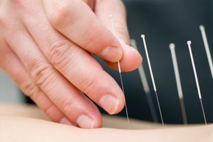 Acupuncture Treatment Clinic in Twin Cities, MN